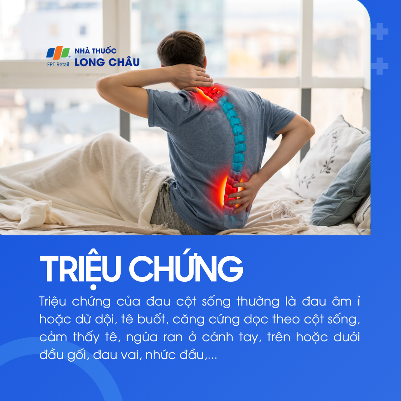Triệu chứng của đau cột sống gồm: đau âm ỉ/dữ dội, căng cứng dọc theo cột sống, tê buốt, nhức đầu, đau lan xuống chân hoặc ta