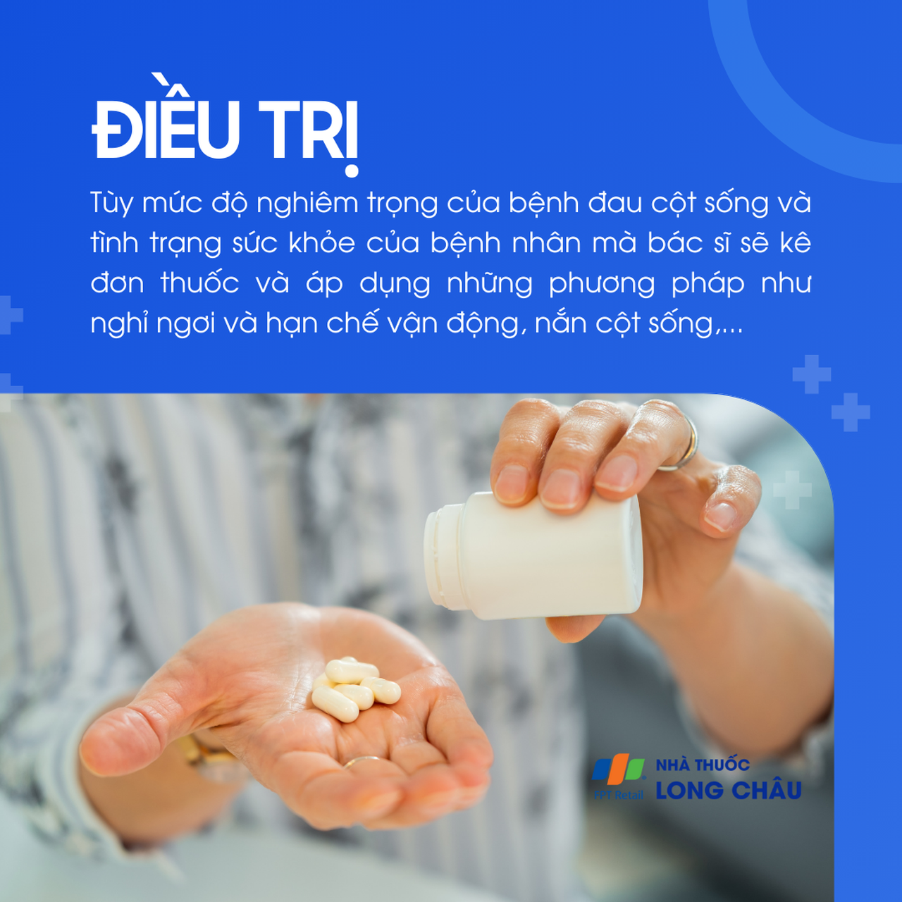 Điều trị đau cột sống tùy theo mức độ nặng nhẹ, thường gồm dùng thuốc, nghỉ ngơi, hạn chế vận động và nắn chỉnh xương khớ