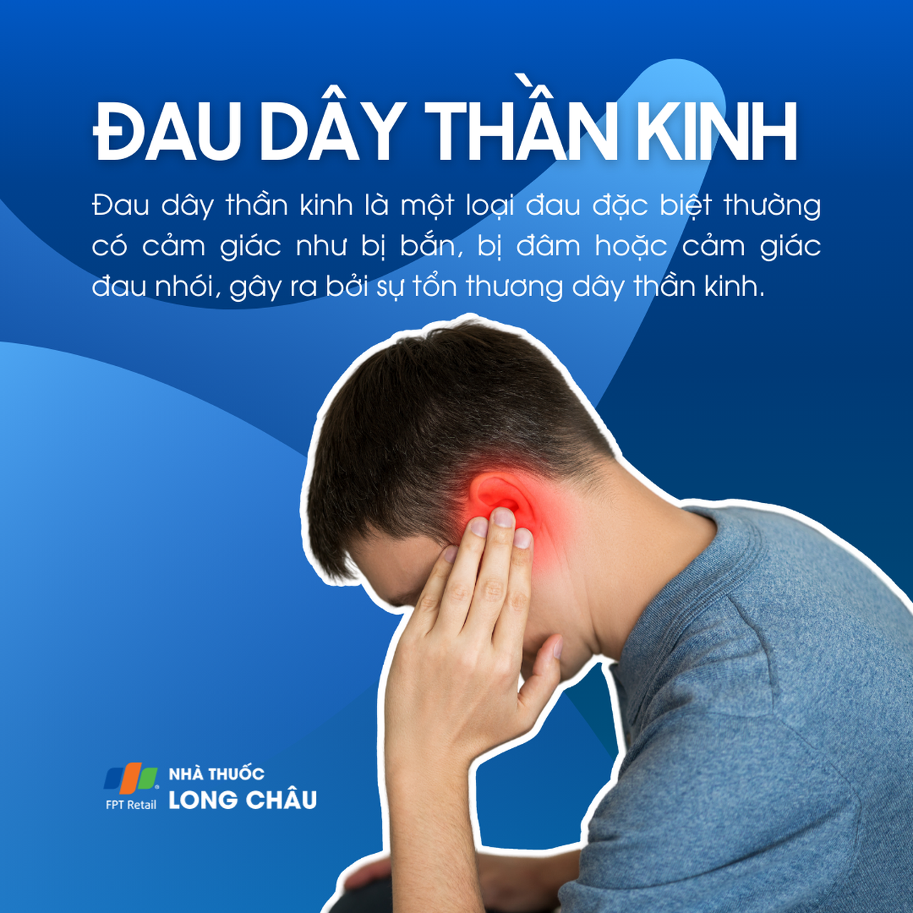 Đau dây thần kinh 1