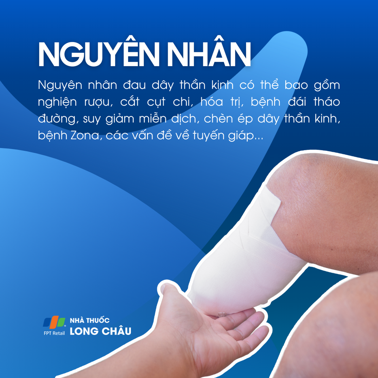 Đau dây thần kinh 3