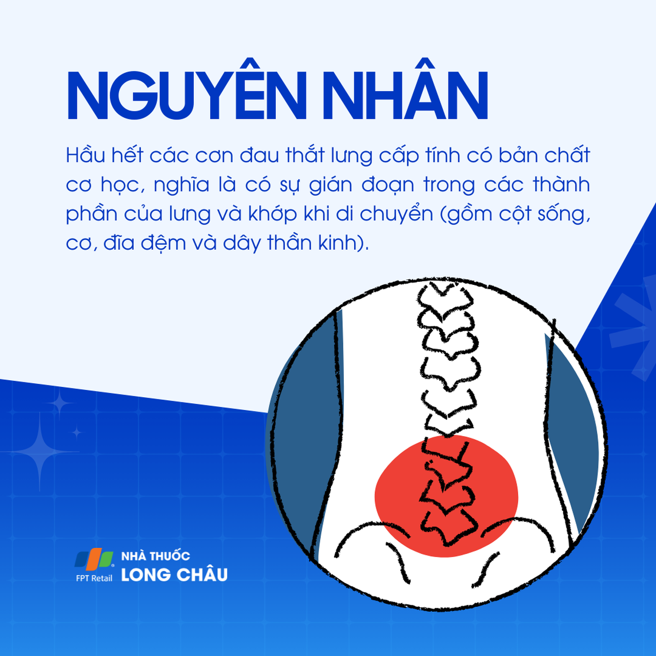 Đau lưng dưới 3