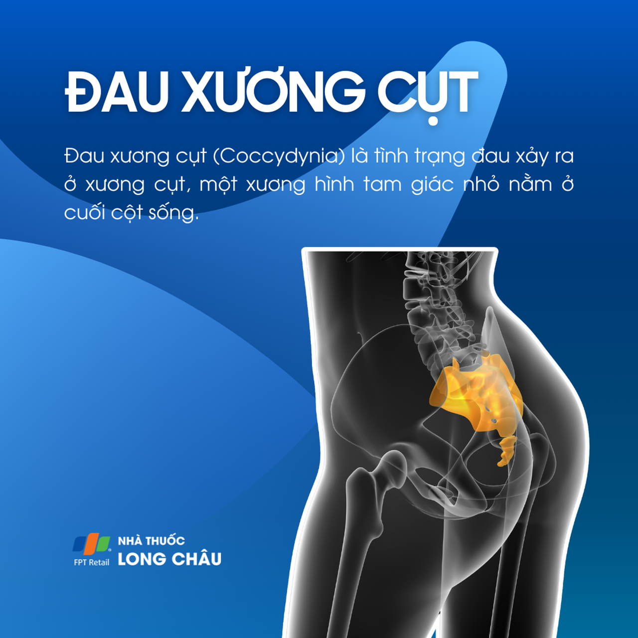 Đau xương cụt 1