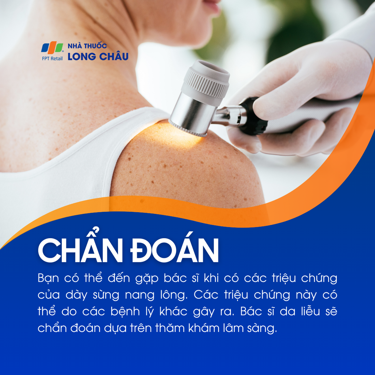 Dày sừng nang lông 5