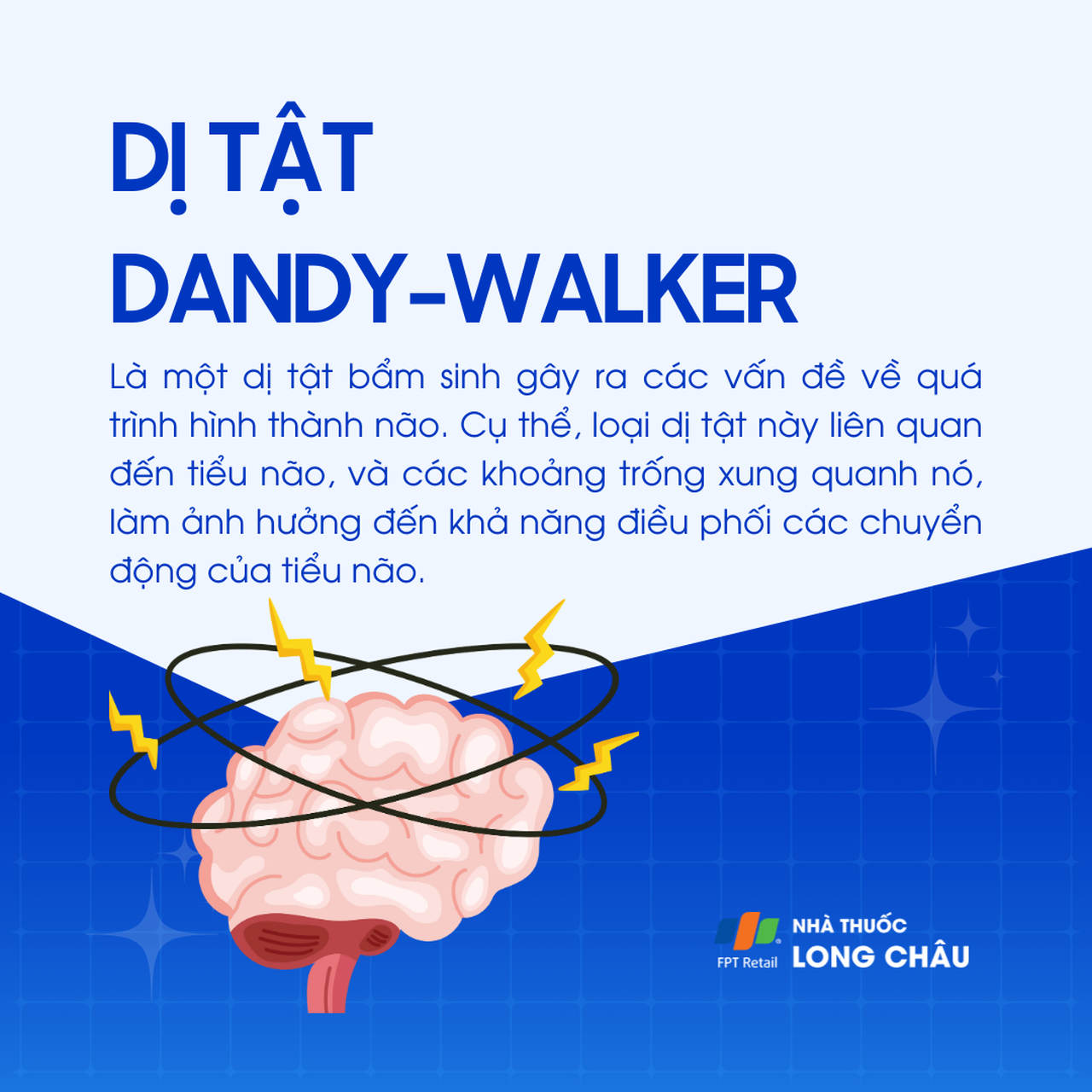 Dị tật Dandy-Walker 1