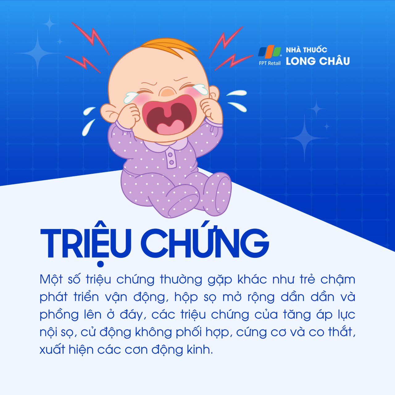 Dị tật Dandy-Walker 2