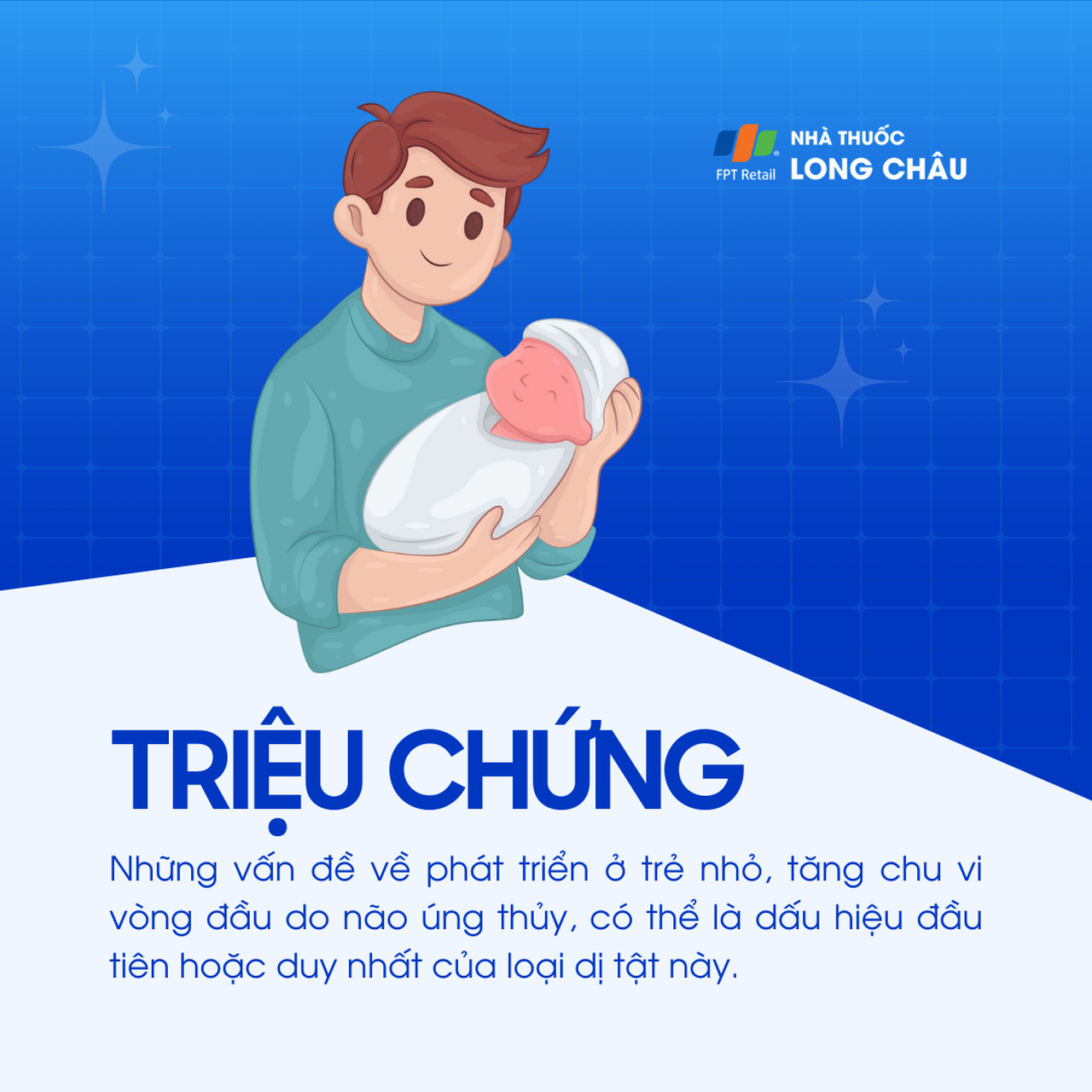 Dị tật Dandy-Walker 3