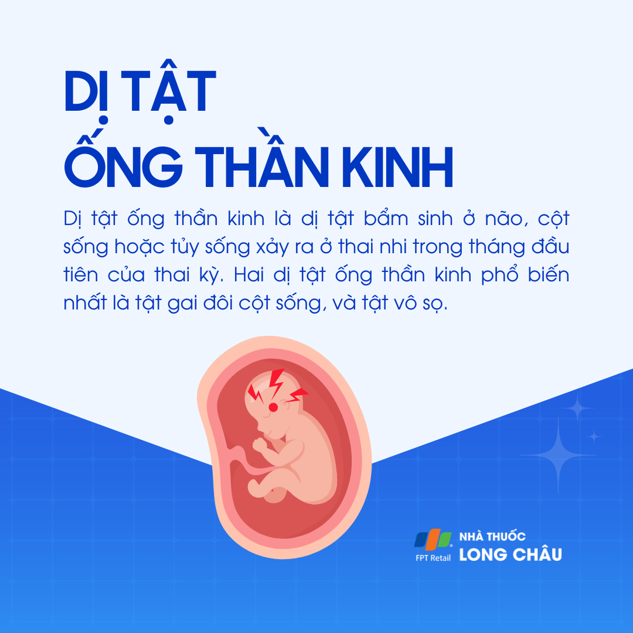 Dị tật ống thần kinh 1