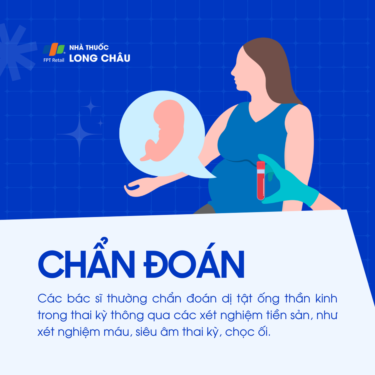 Dị tật ống thần kinh 3