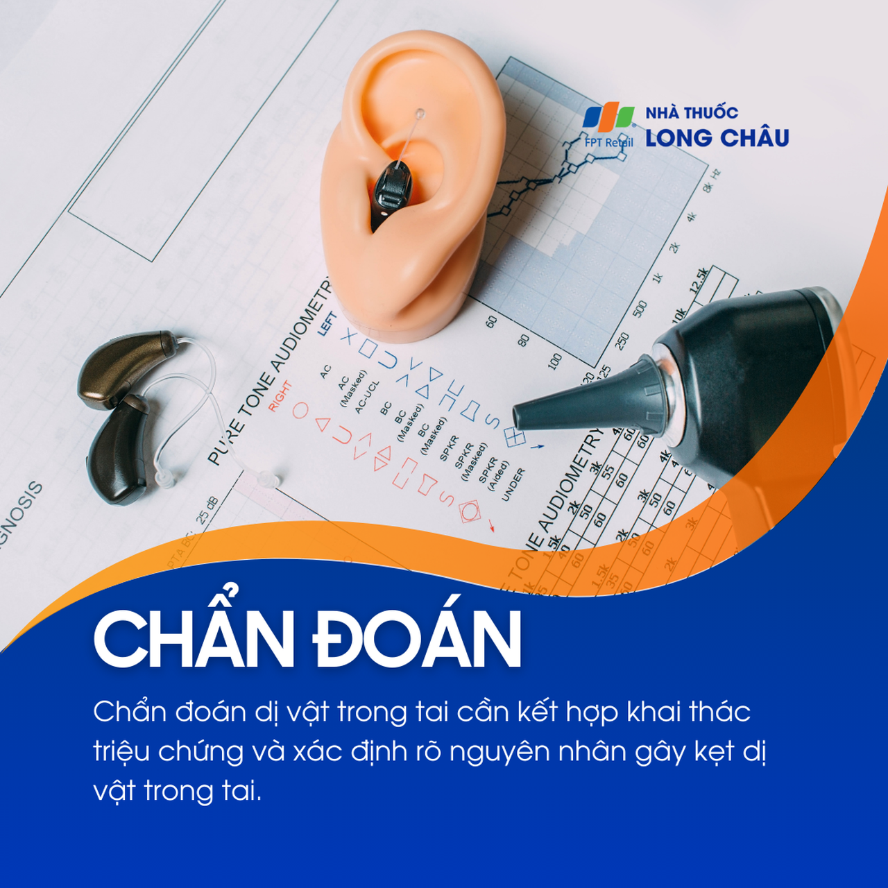 Dị vật trong tai 5