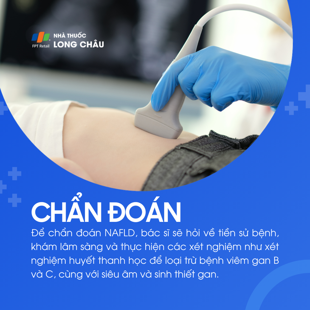 Gan nhiễm mỡ không do rượu 5