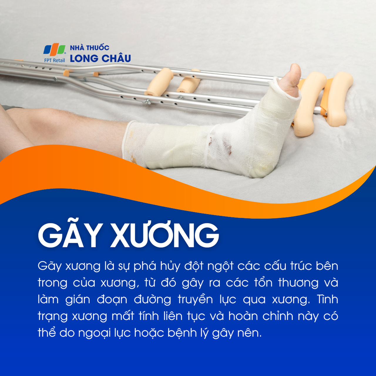 Gãy xương 1