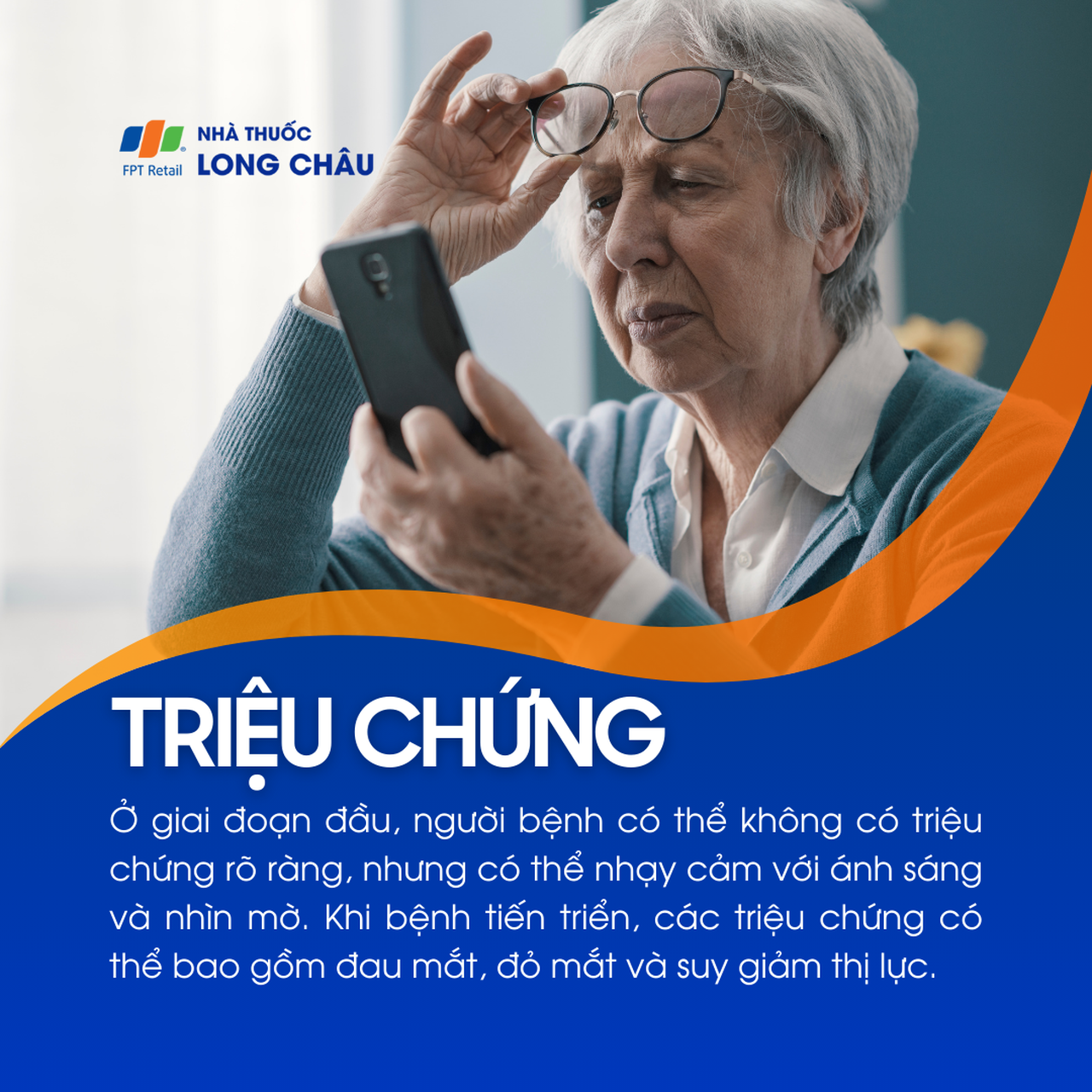 Glocom tân mạch 2