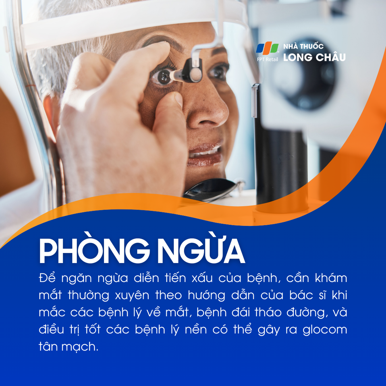 Glocom tân mạch 7