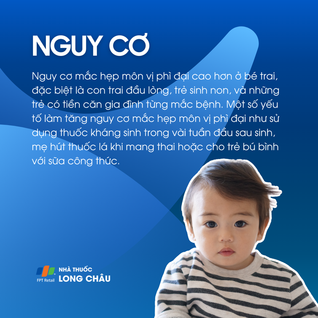 Hẹp môn vị phì đại 4