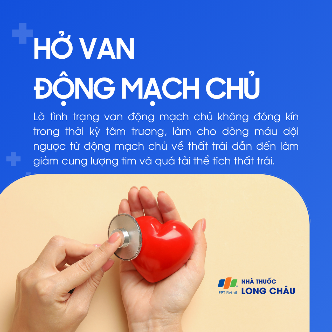 Hở van động mạch chủ 1