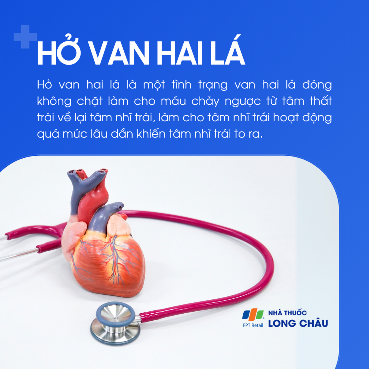 Hở van hai lá 1
