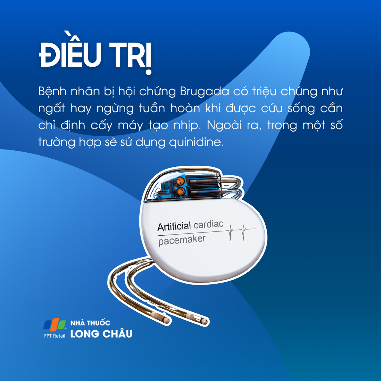 Hội chứng Brugada 6