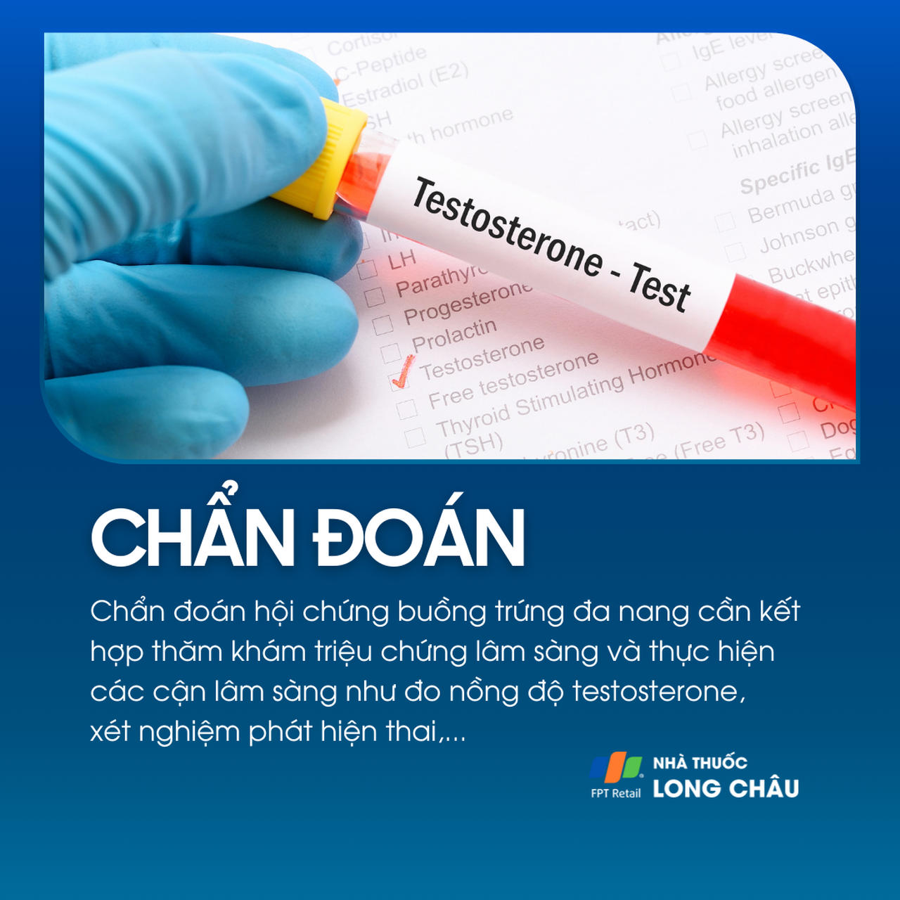 Hội chứng buồng trứng đa nang 5