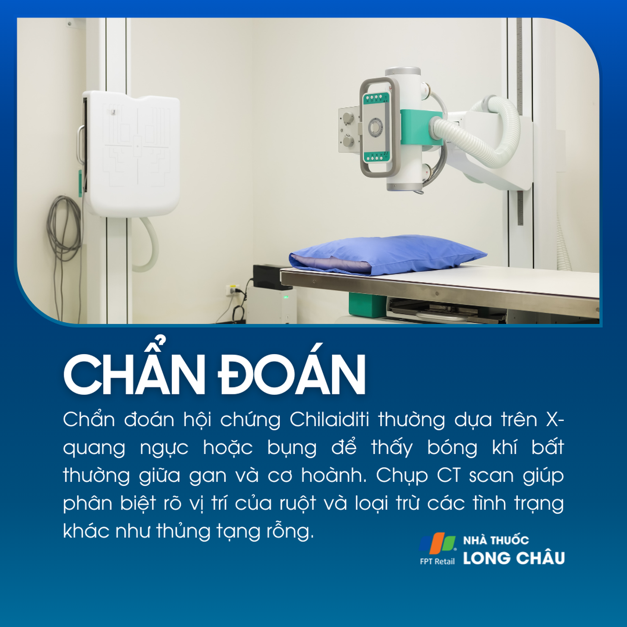 Hội chứng Chilaiditi 5