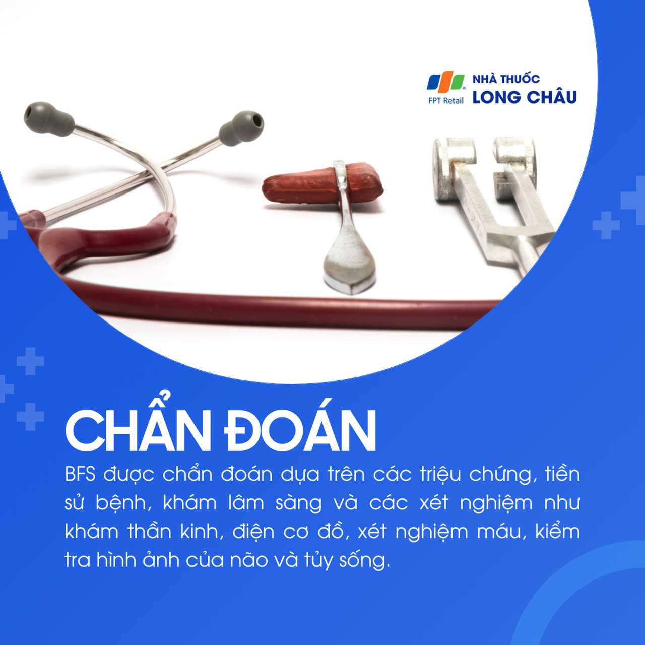 Hội chứng rung giật cơ lành tính 5