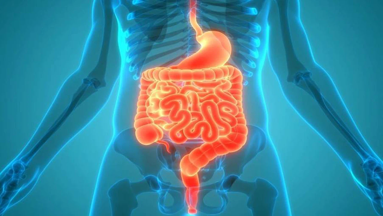 Bệnh Crohn: Nguyên nhân, triệu chứng, phương pháp điều trị 3