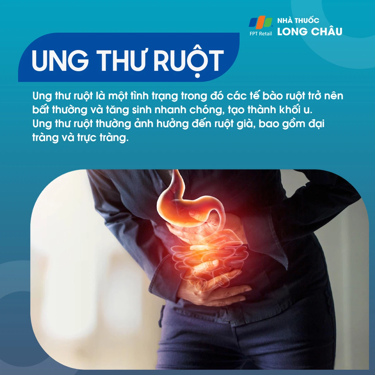 ung thư ruột 1