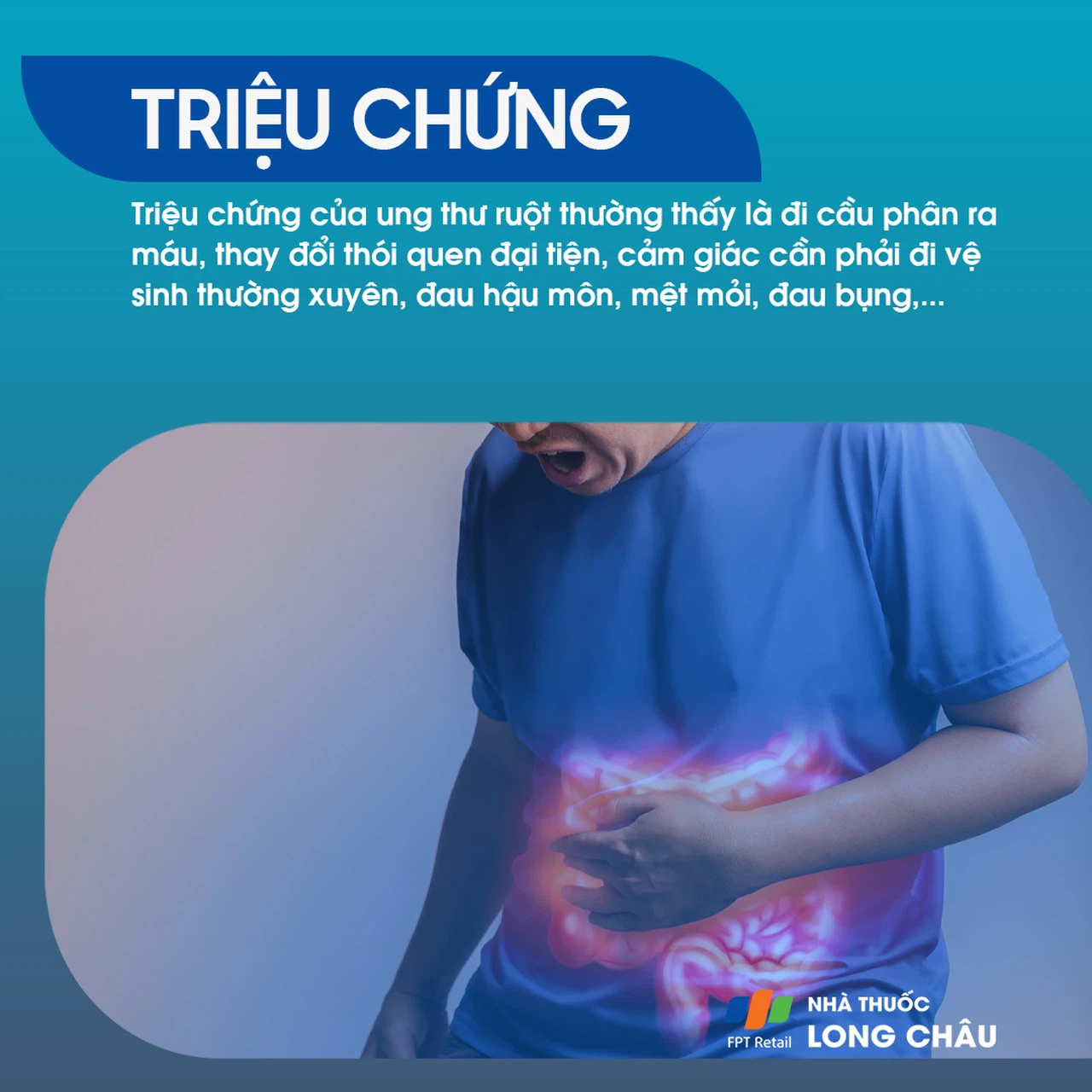 ung thư ruột 2
