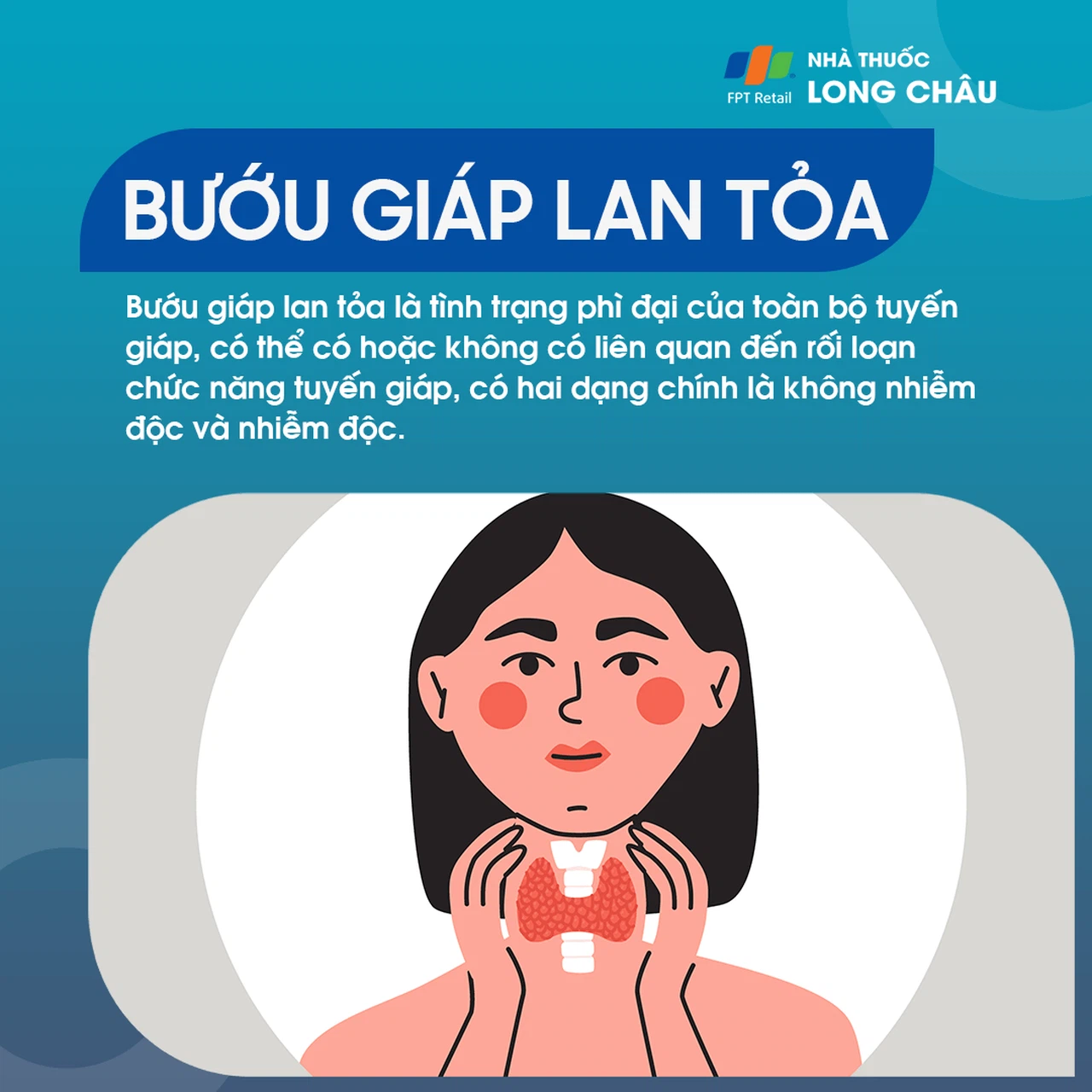 Tuyến giáp lan tỏa là gì? Nguyên nhân và cách điều trị