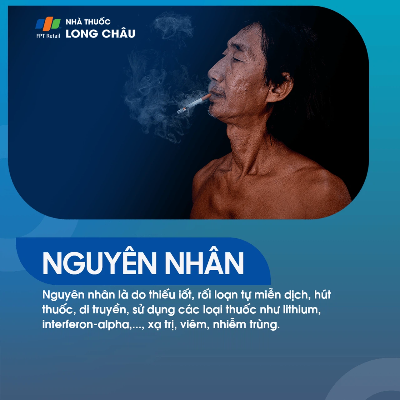 Bướu giáp lan tỏa 2