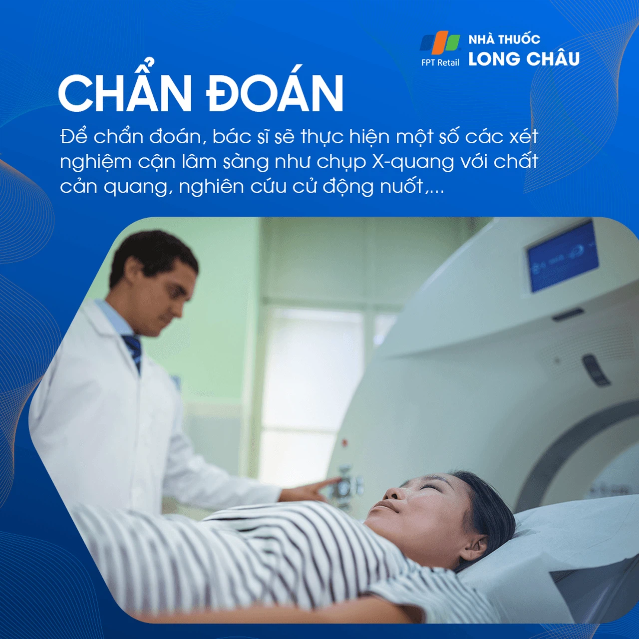 Chứng khó nuốt 5