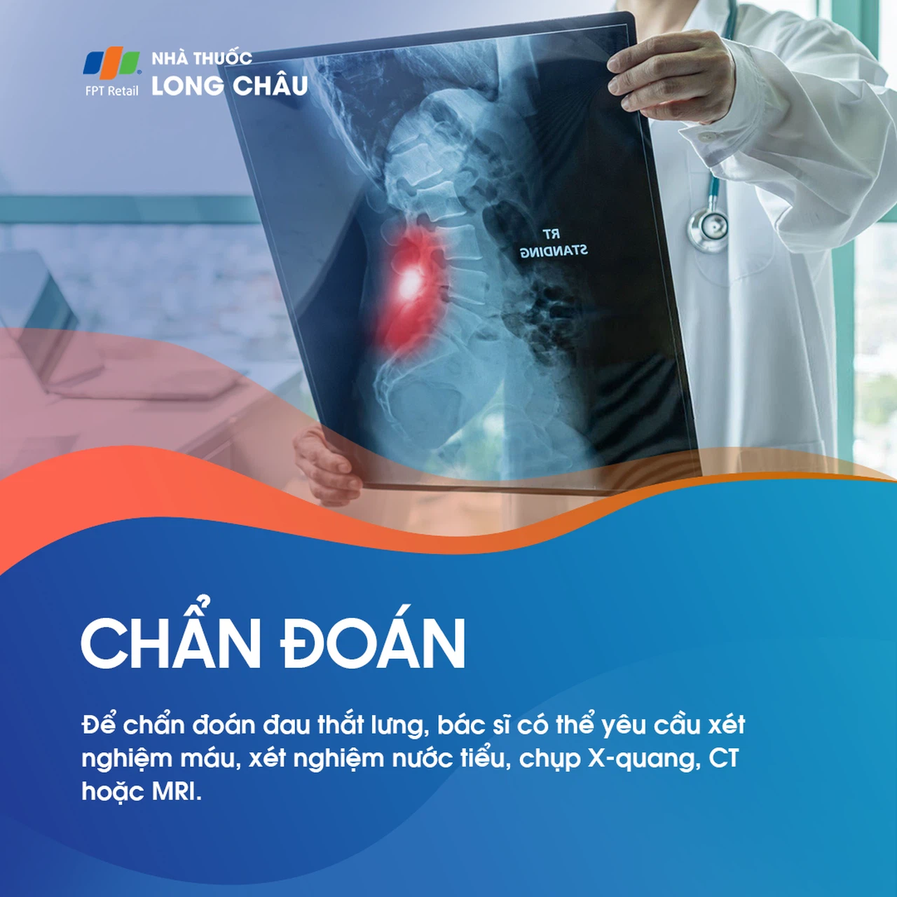 Đau thắt lưng 4
