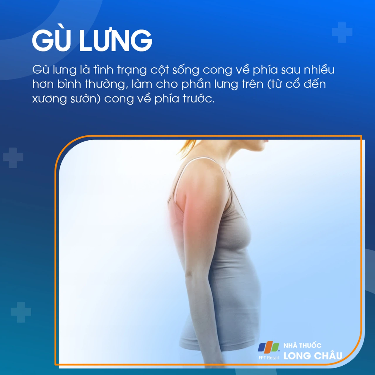 Gù Lưng 1