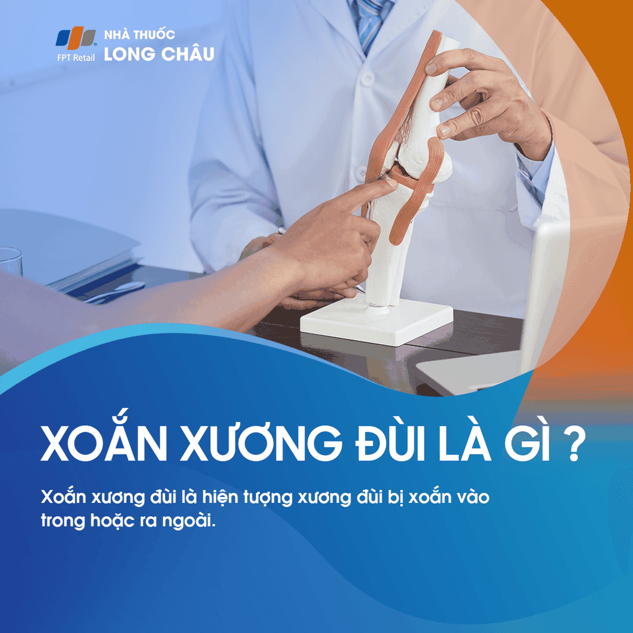 Xoắn Xương Đùi 1