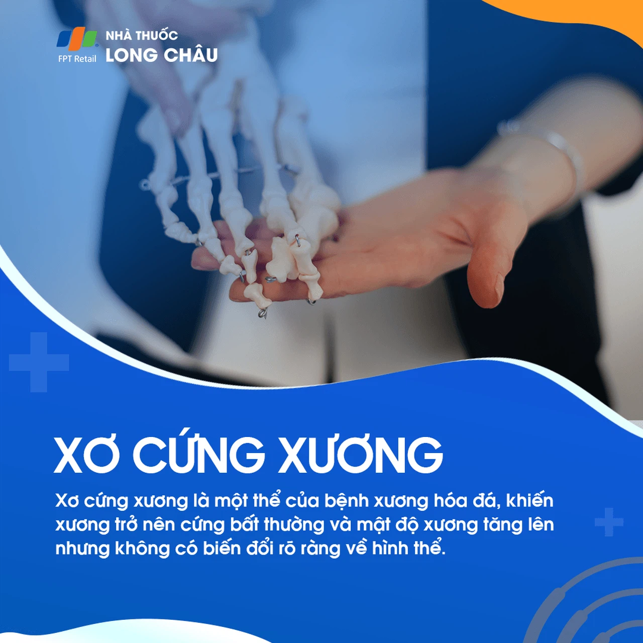 Xơ Cứng Xương 1
