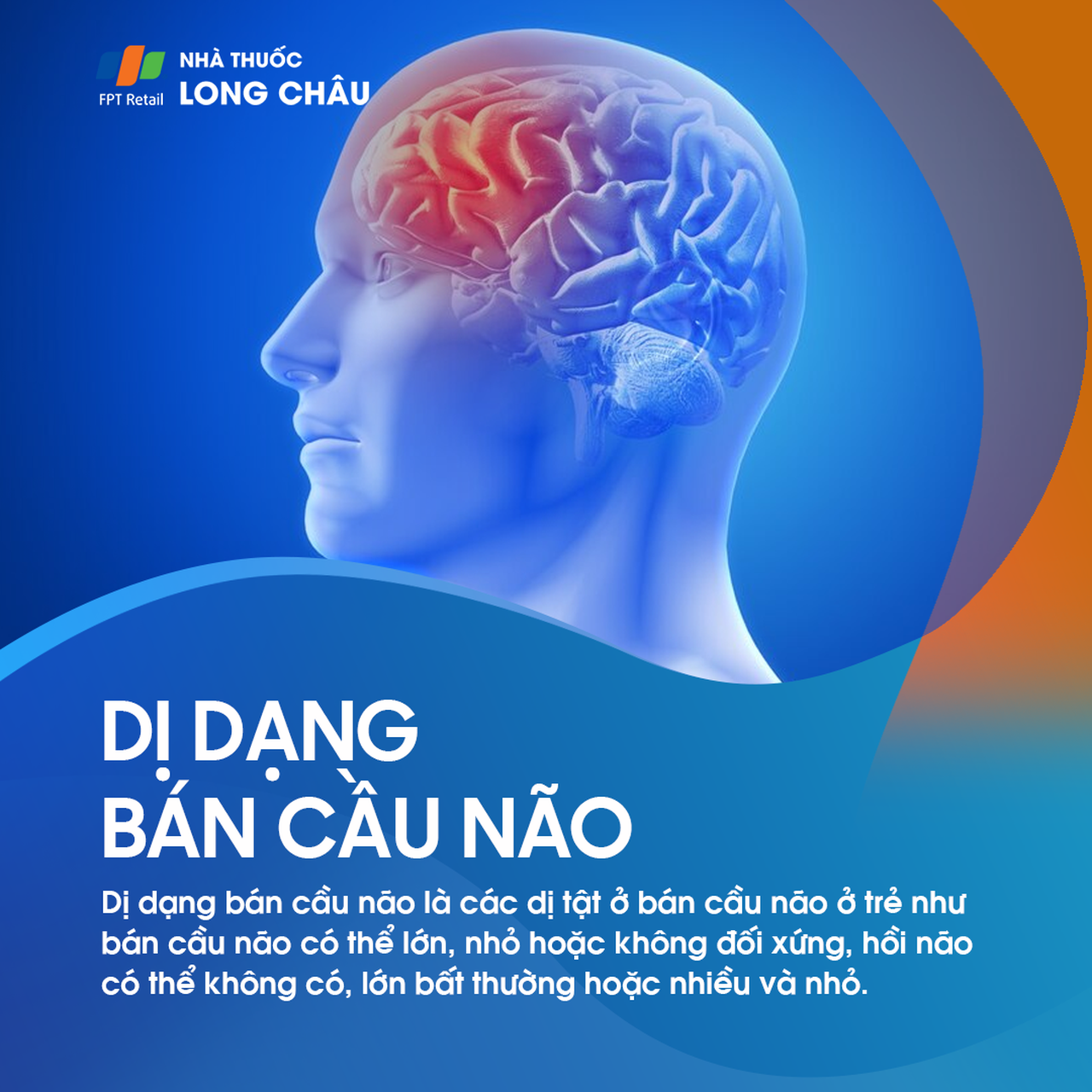 Dị dạng bán cầu não 1