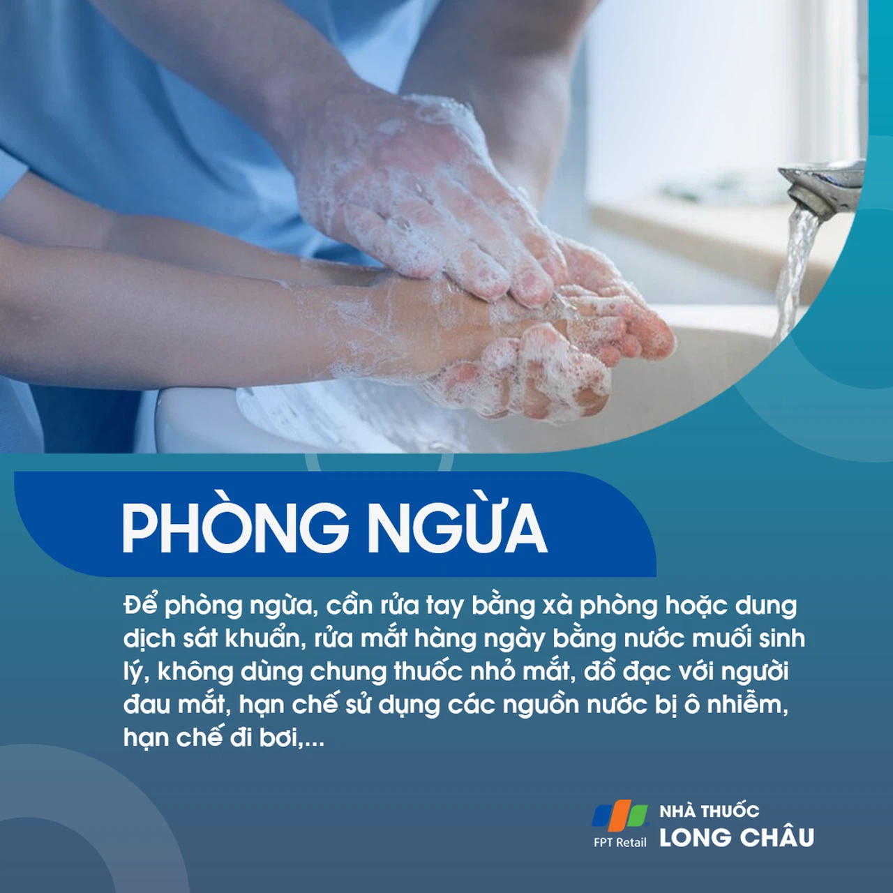 Mắt đỏ 7