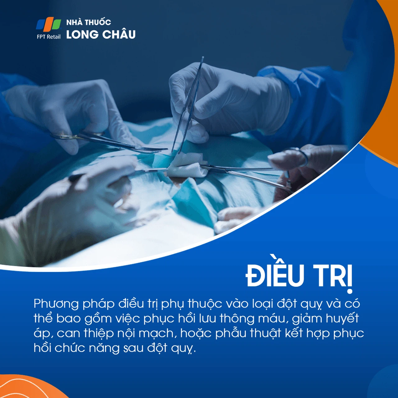 Đột quỵ não 7