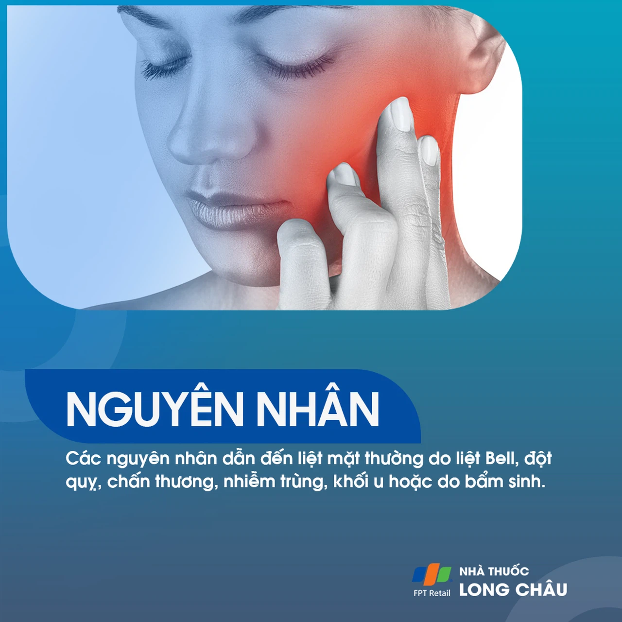 Liệt mặt 3