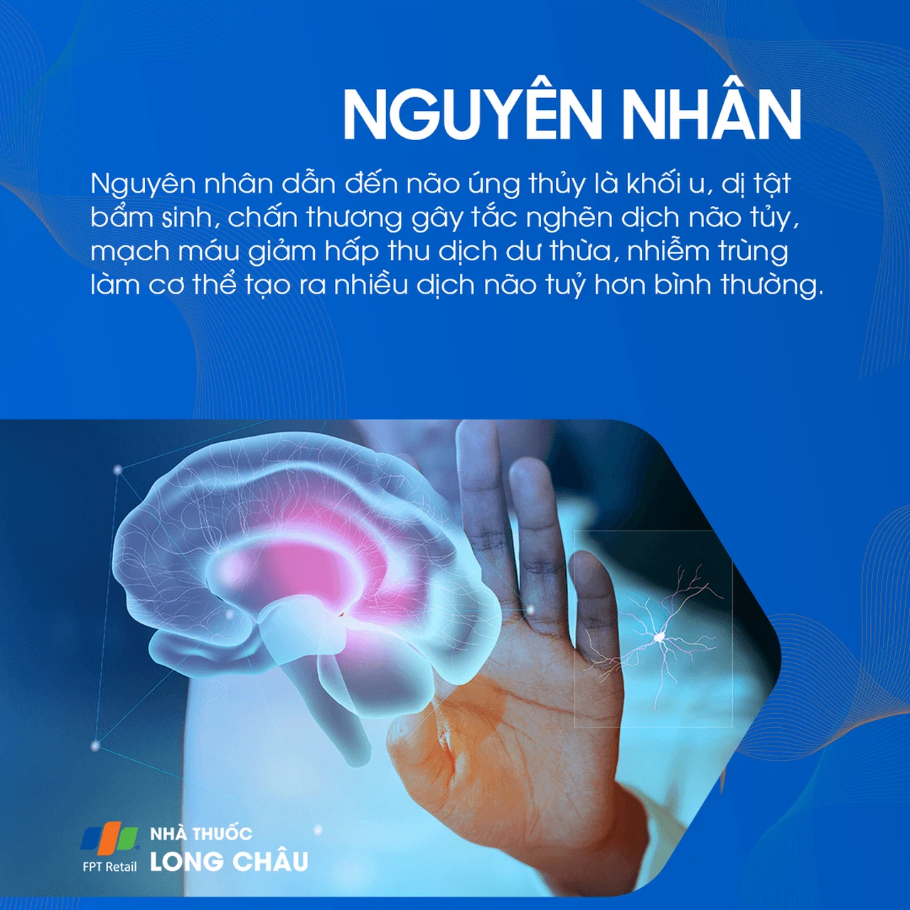 Não úng thủy 3