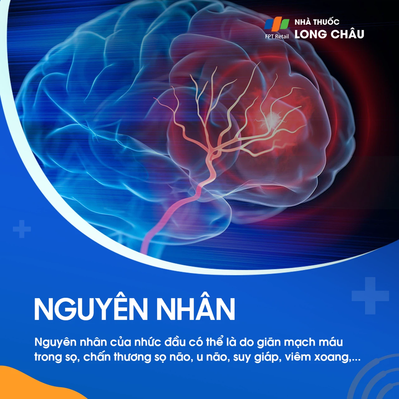 Căng thẳng, mất ngủ, thiếu nước, và các vấn đề về thị lực là những nguyên nhân 