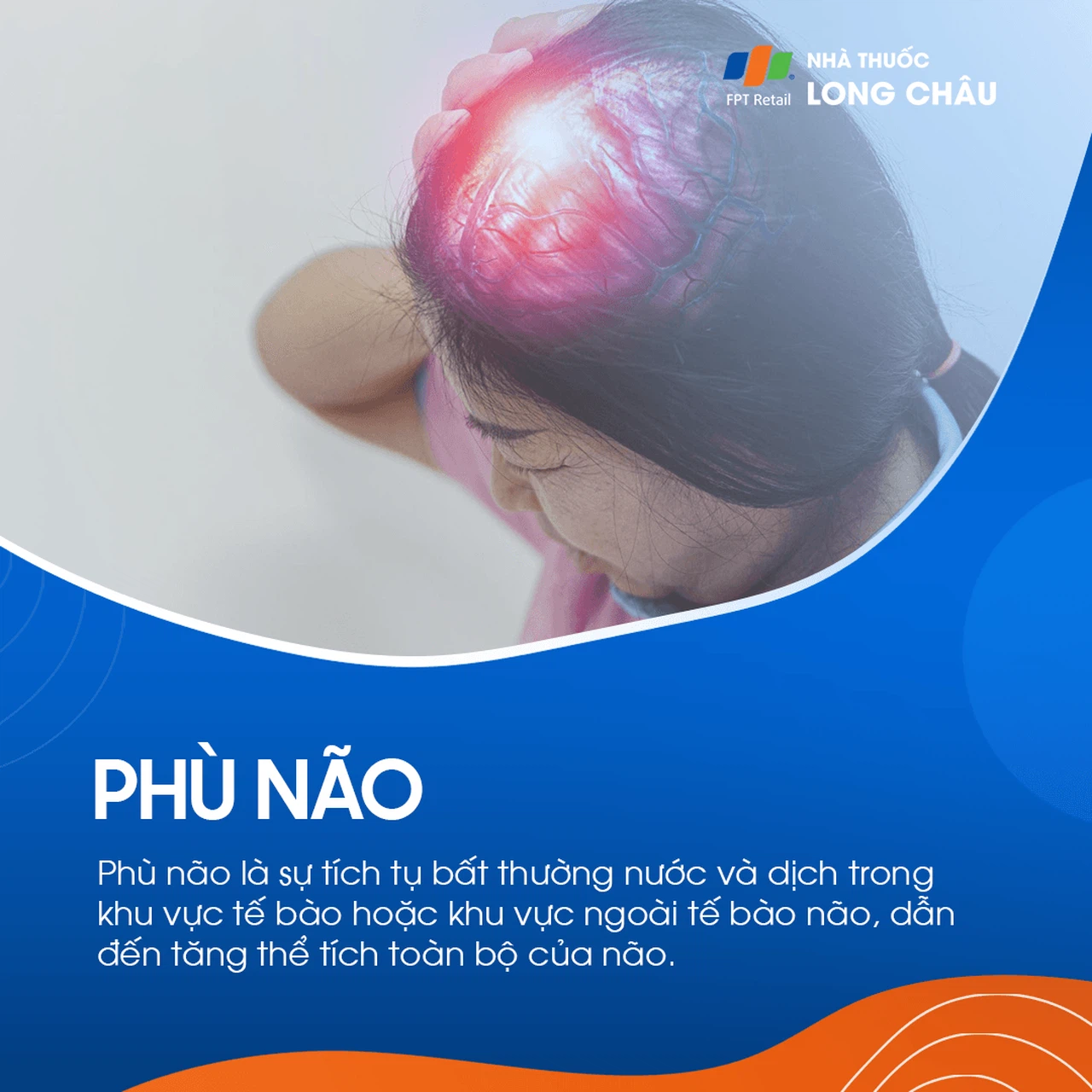 Phù não 1