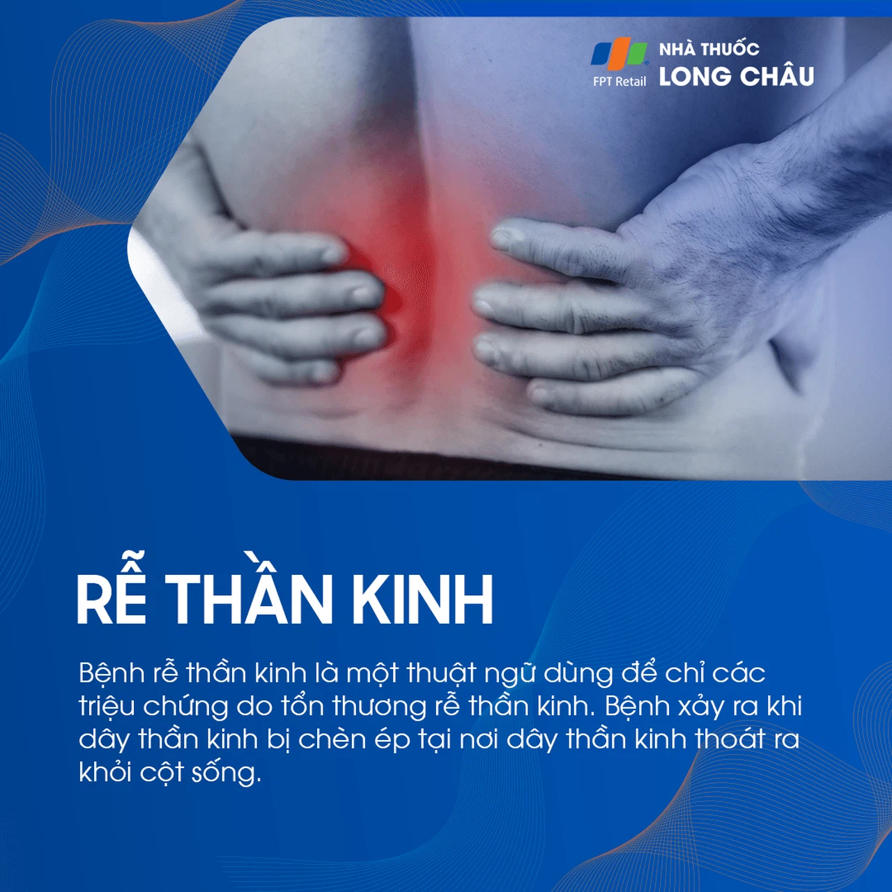 Rễ Thần Kinh 1