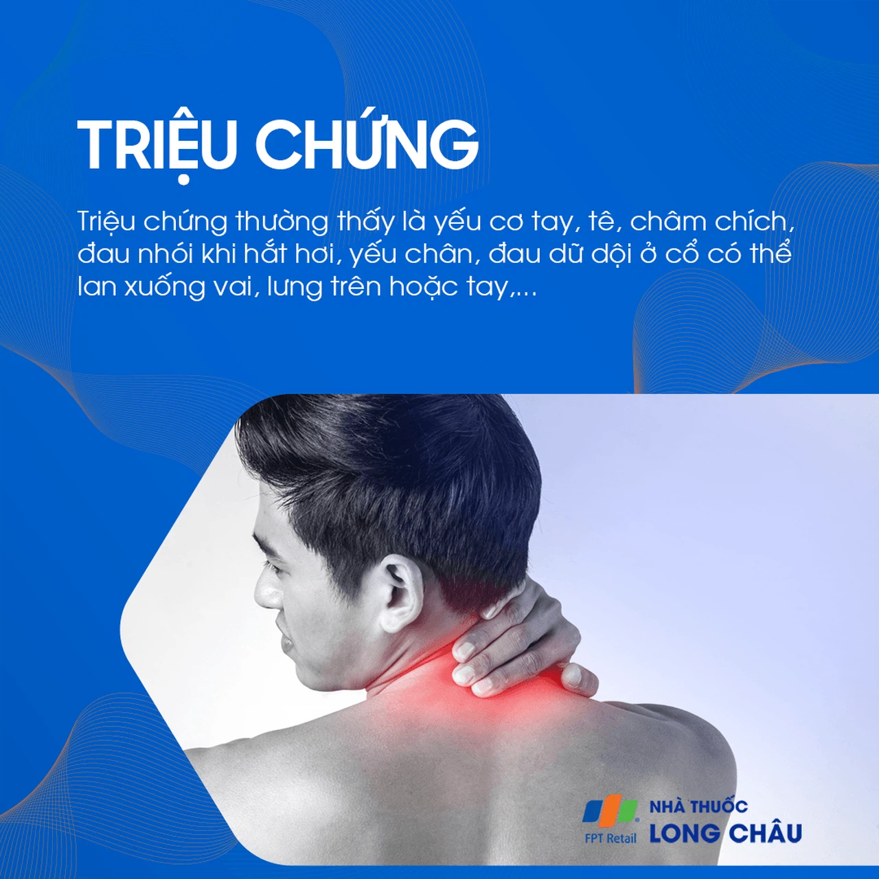 Rễ Thần Kinh 2