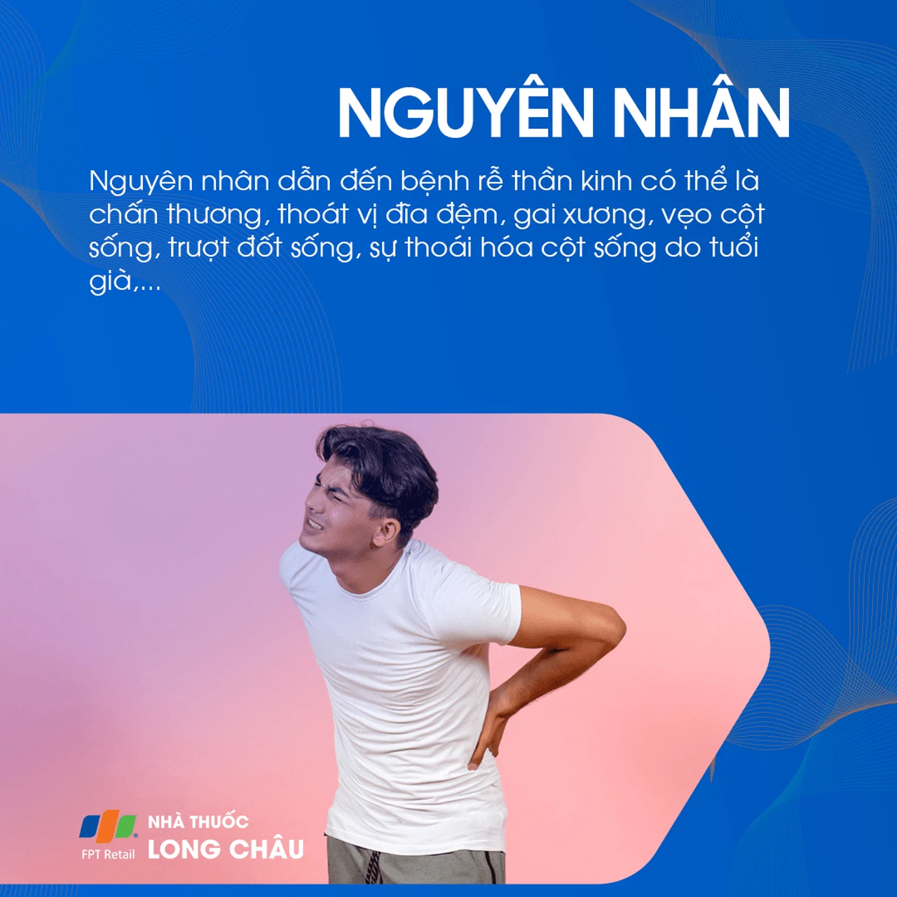 Rễ Thần Kinh 3