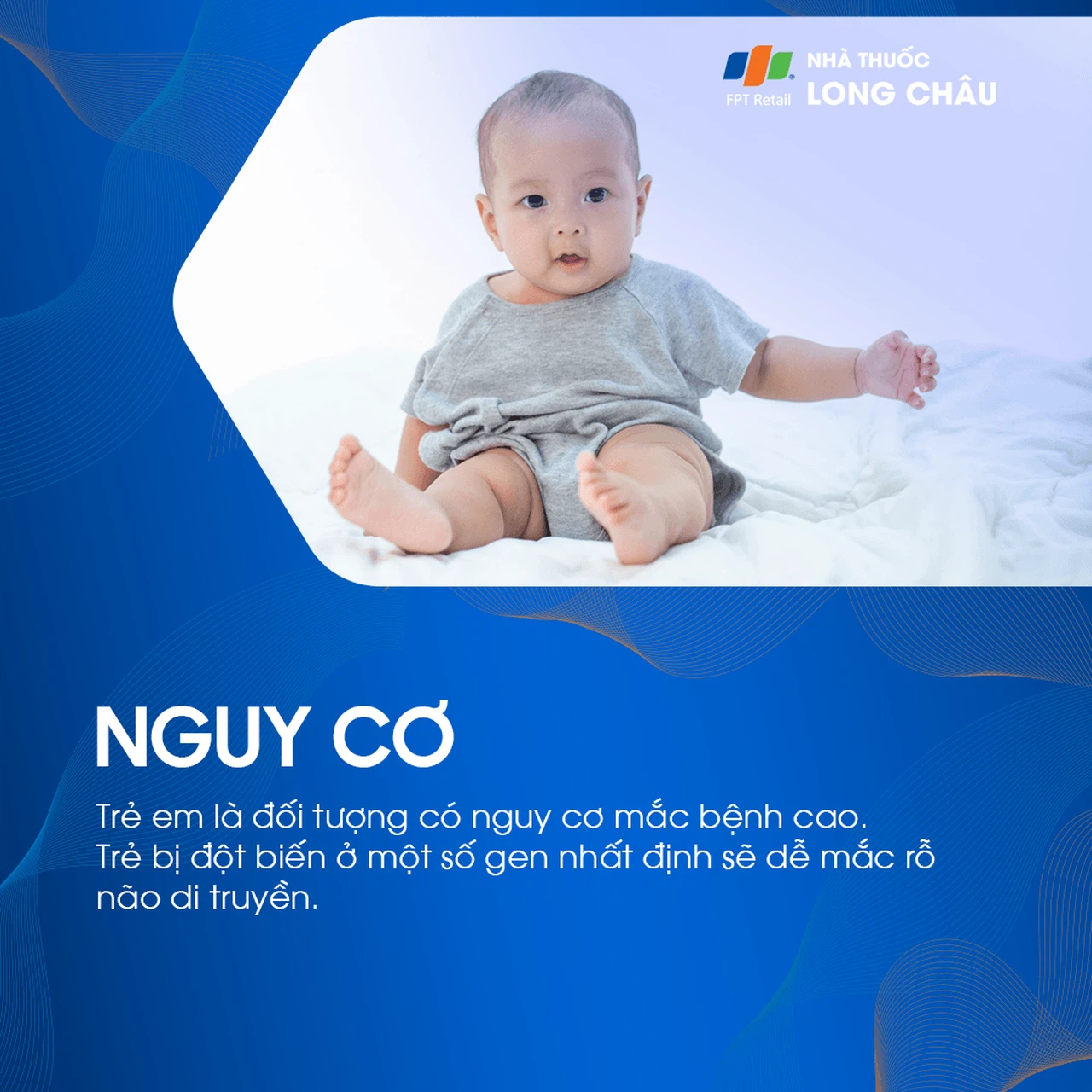 Rỗ não 4