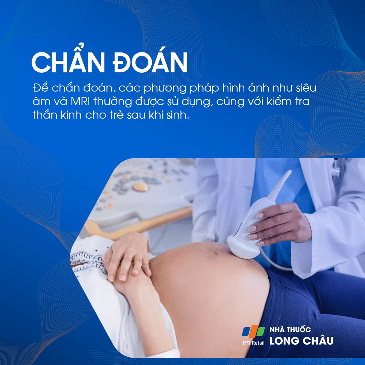 Rỗ não 5
