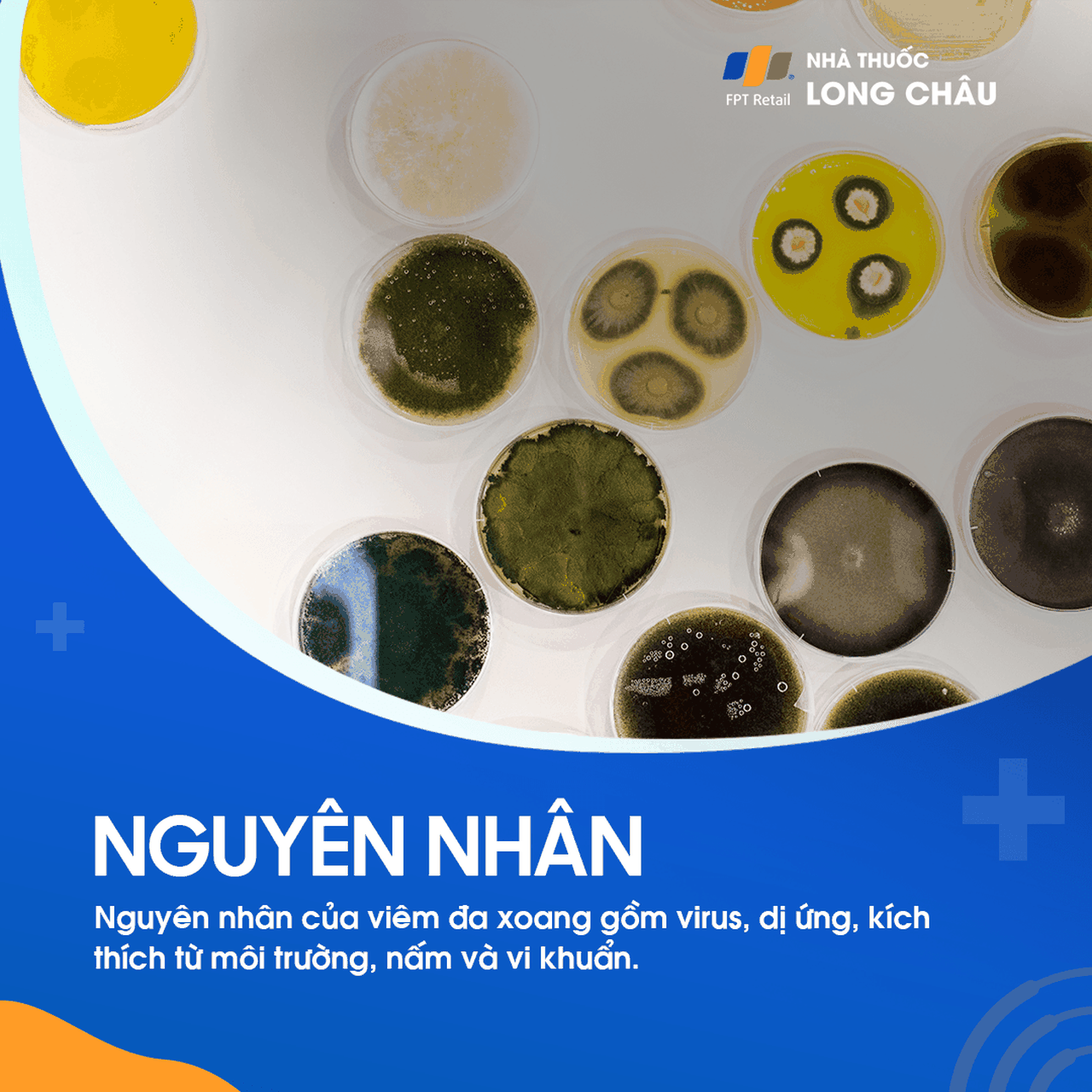Viêm đa xoang 3