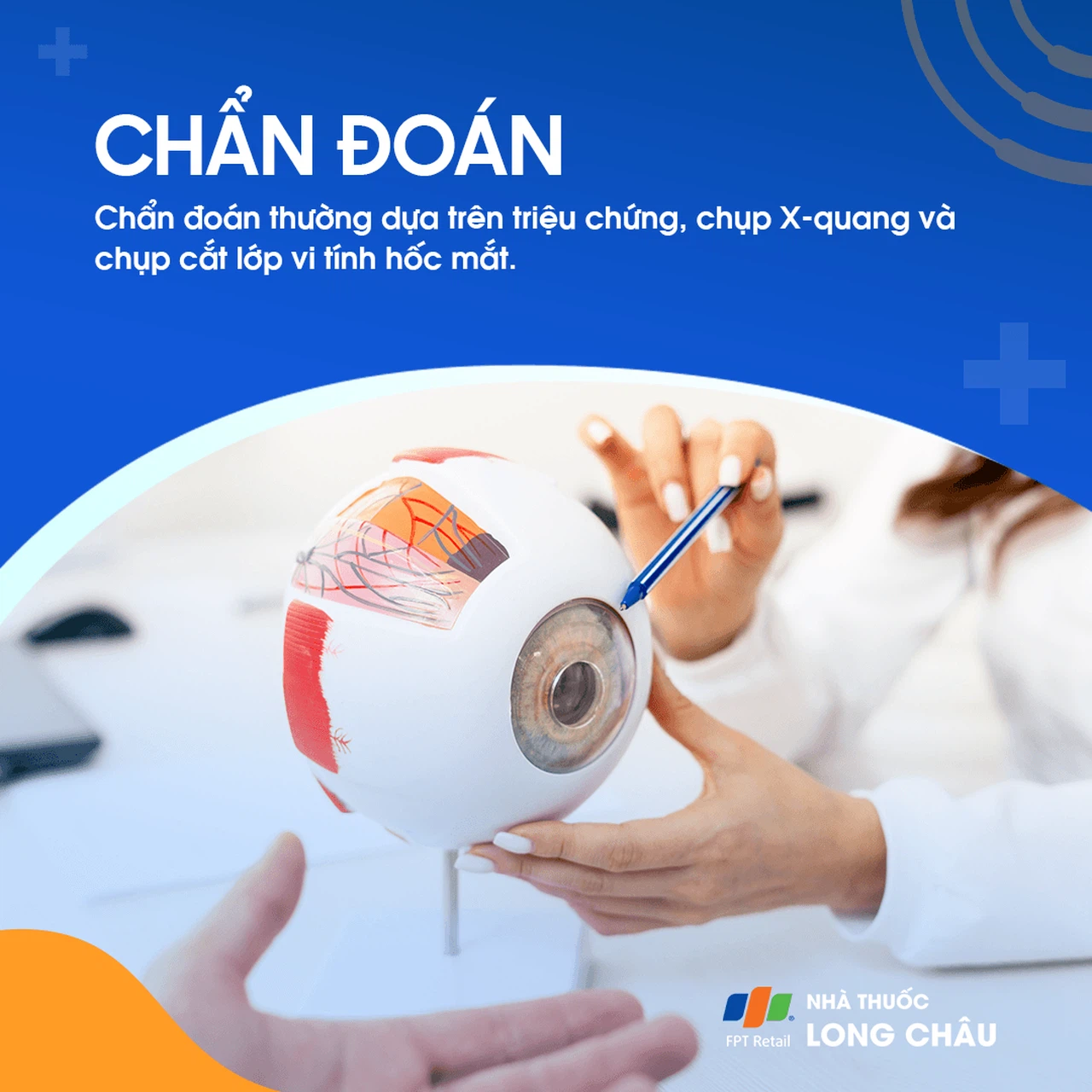 Viêm đa xoang 5