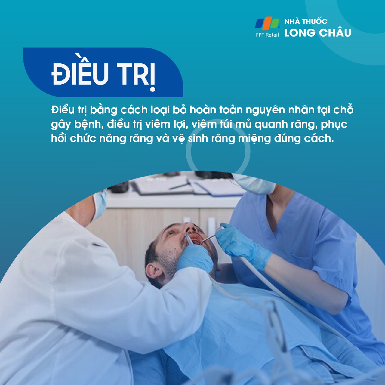 Viêm quanh răng 6