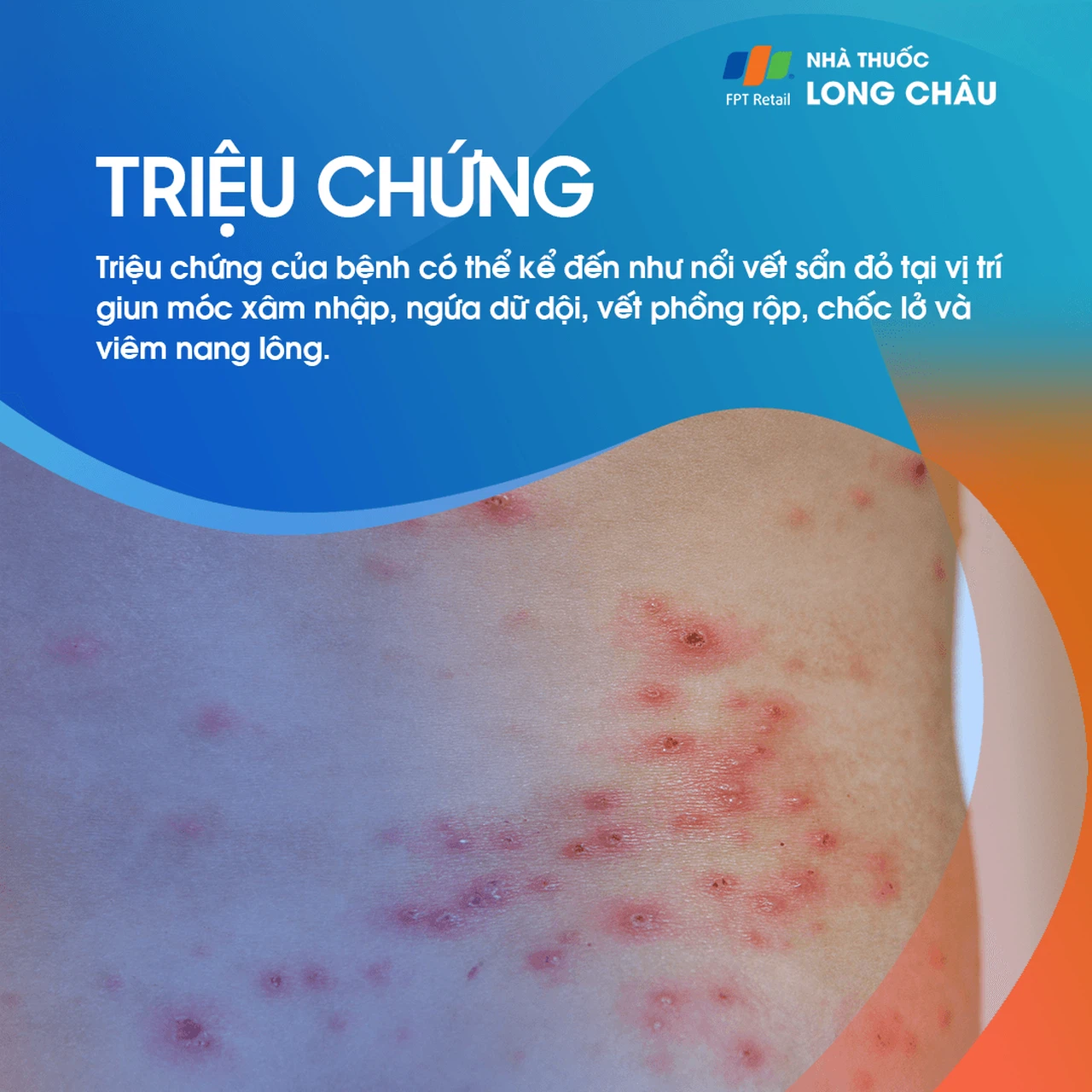 Ấu trùng da di chuyển 2